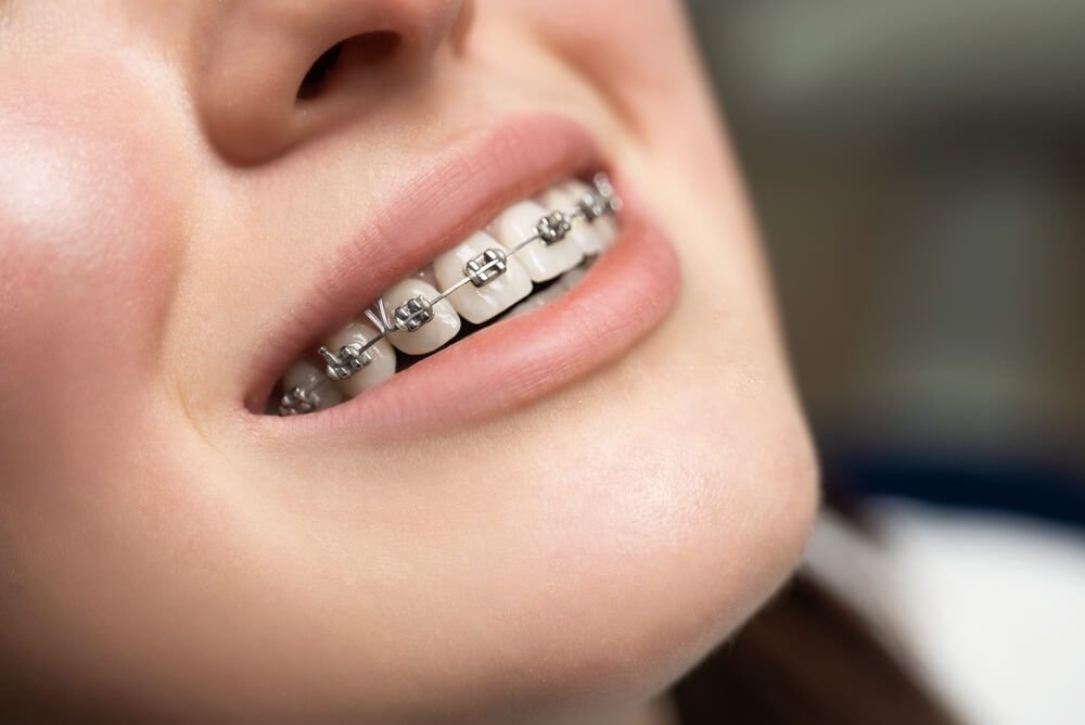 orthodontists in Abu Dhabi